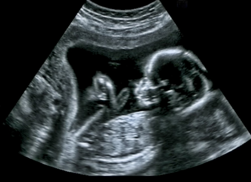grossesse et développement du bébé